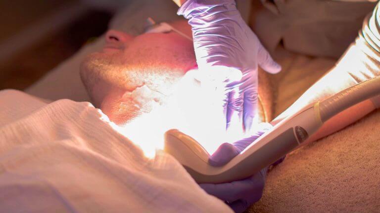 IPL-Laser-Facial-Treatment