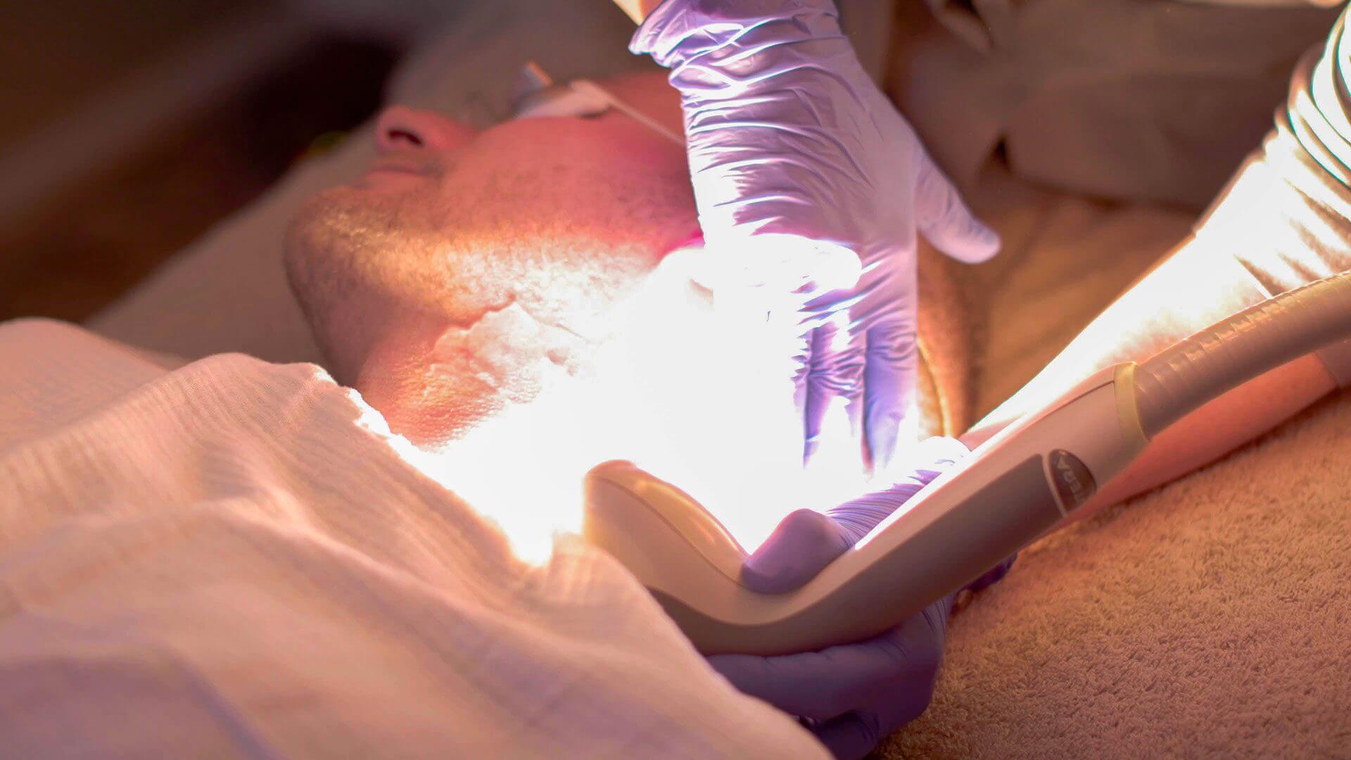 IPL-Laser-Facial-Treatment