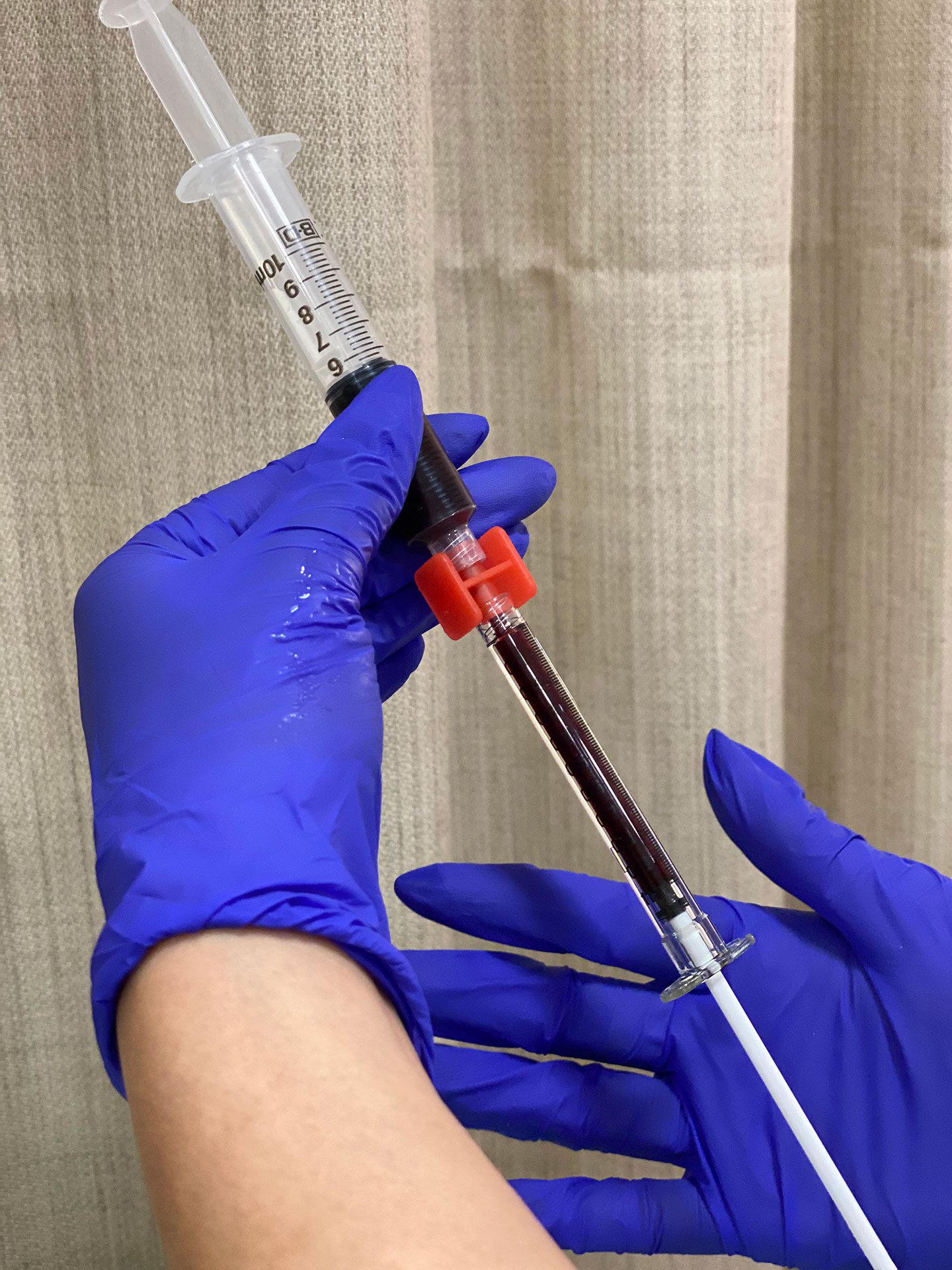 The-treatment-of-championss