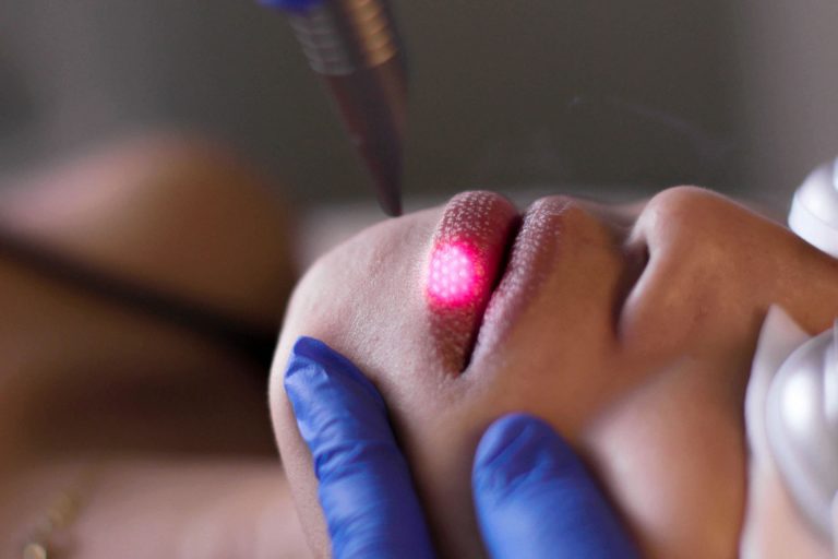 no-filler-lip-plumping